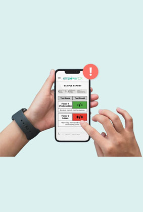 Factor V & Prothrombin Gene Test – Thrombophilia Genetic Test